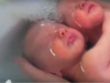 Úžasné video: Dvojičky v kúpeli sa cítia ako v brušku dvojičky v objatí