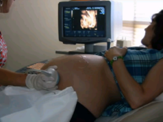 Video o tehotenstve: Čo budúcu mamičku čaká v treťom trimestri žena na ultrazvuku