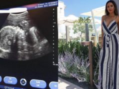 Neuveriteľné: Je v siedmom mesiaci tehotenstva – a má sixpack!!!